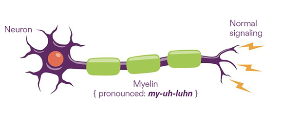 CIDP attacks myelin