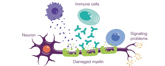 CIDP attacks myelin